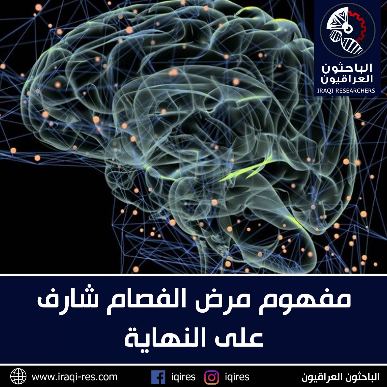 مفهوم مرض الفصام شارف على النهاية الباحثون العراقيون